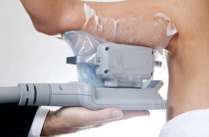 fat freezing arms Berkhamsted