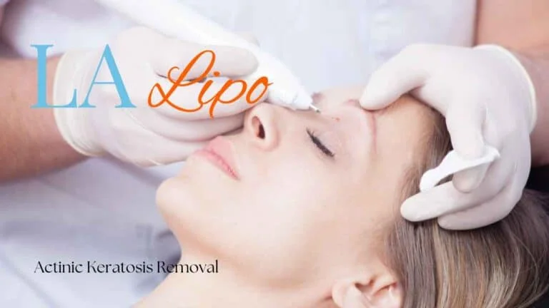 Woman receiving Actinic Keratosis Removal Treatment Berkhamsted