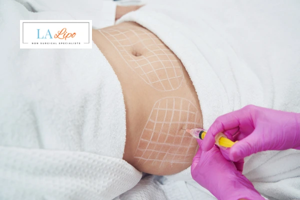 aqualyx fat dissolving injections Berkhamsted