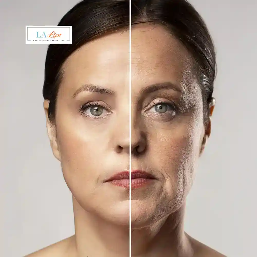 How Can You Tell If Non-Surgical Skin Tightening Is Right for You Berkhamsted?