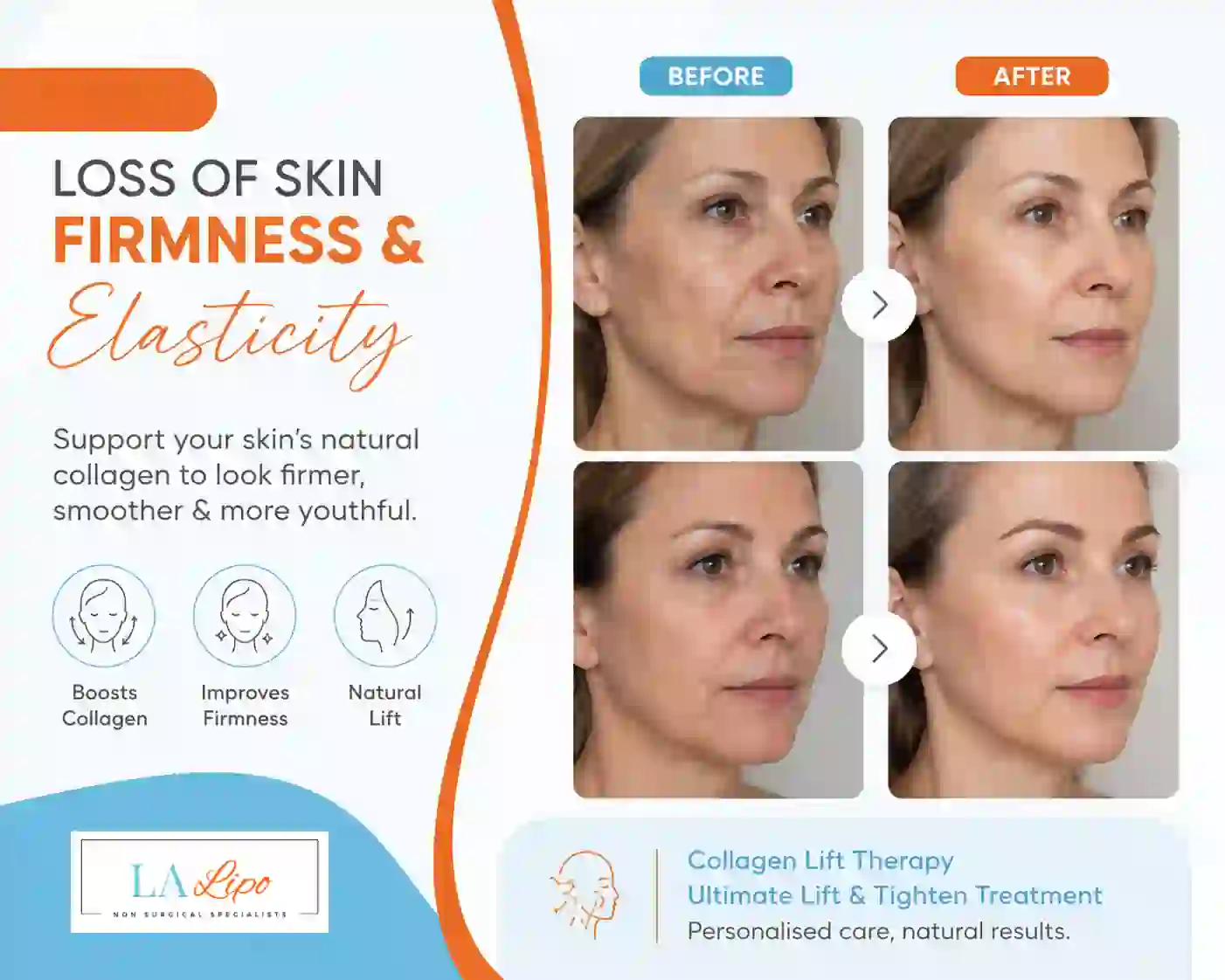 Sign #7: Loss of Skin Firmness and Elasticity Berkhamsted